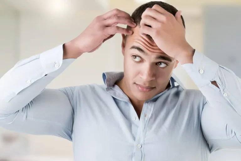 male hairloss