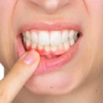 Teeth