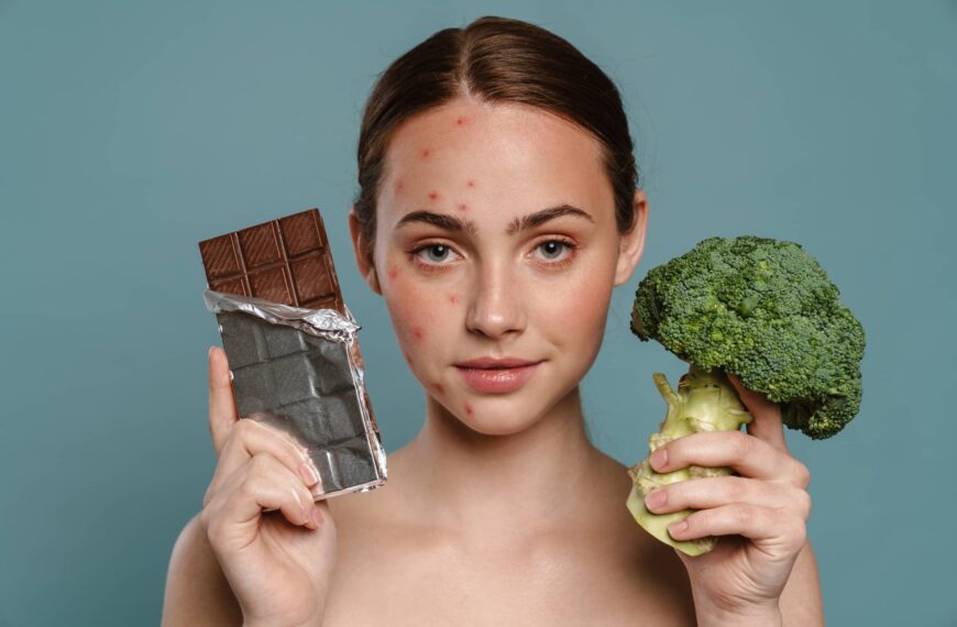 woman with spots posing with chocolate and broccoli