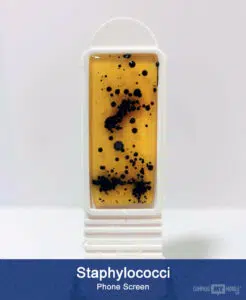 Phone staph