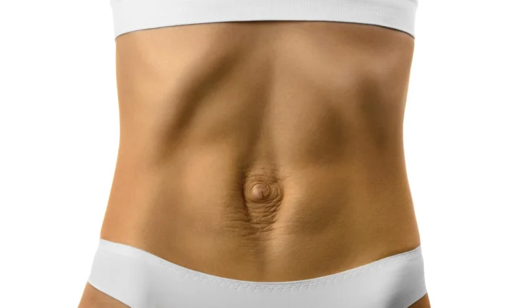 diastasis recti scaled