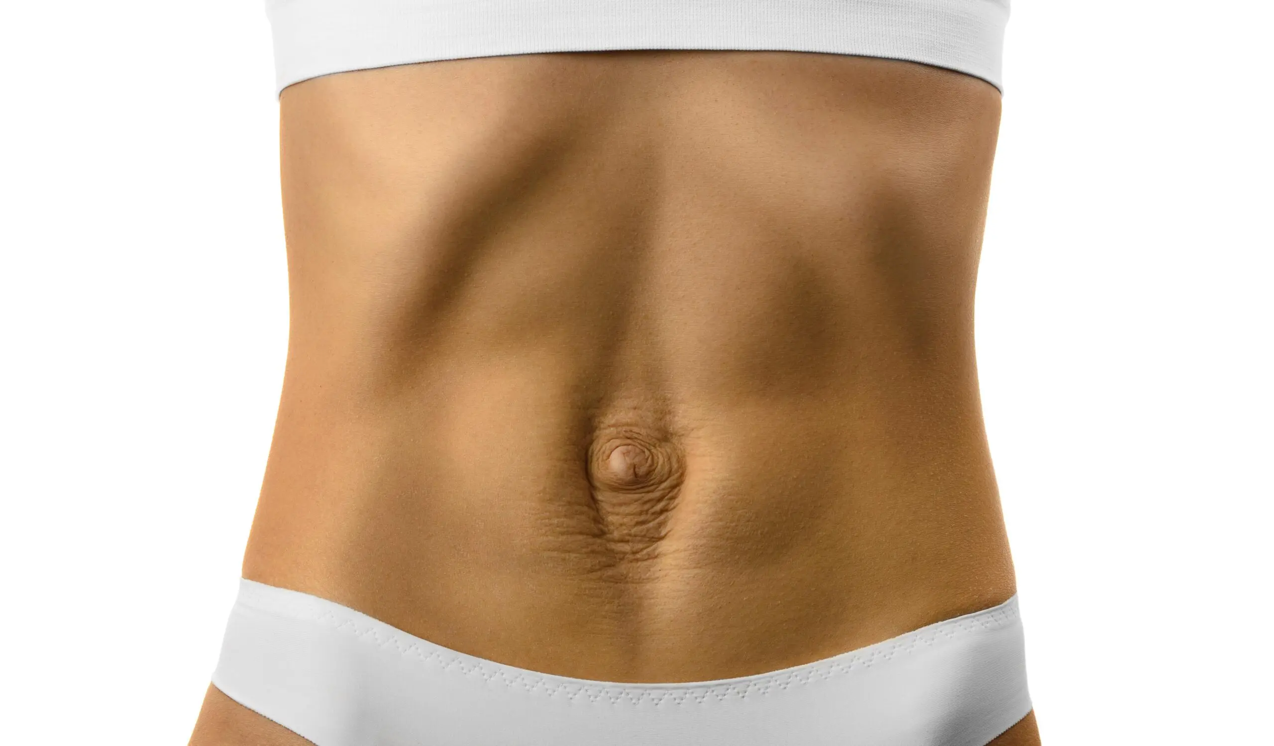 Diastasis recti scaled