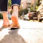 how to treat cracked heels scaled
