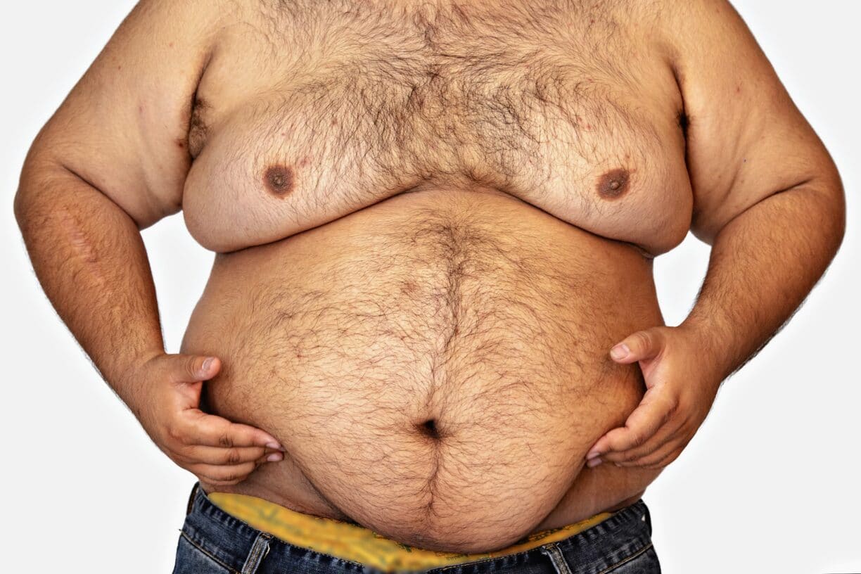 overweight man