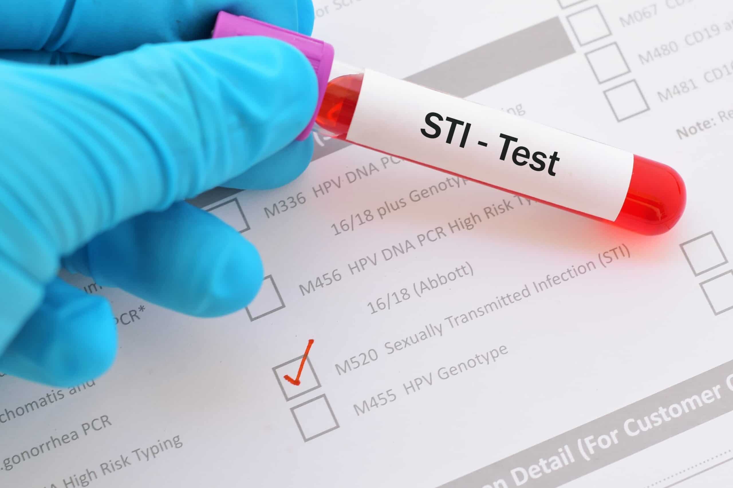 How often should you actually go for an sti test?