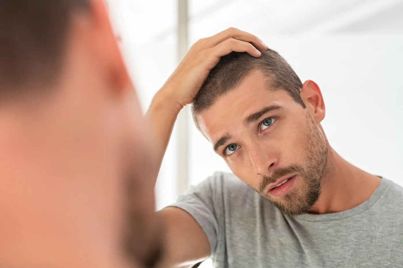 7 common causes of hair loss