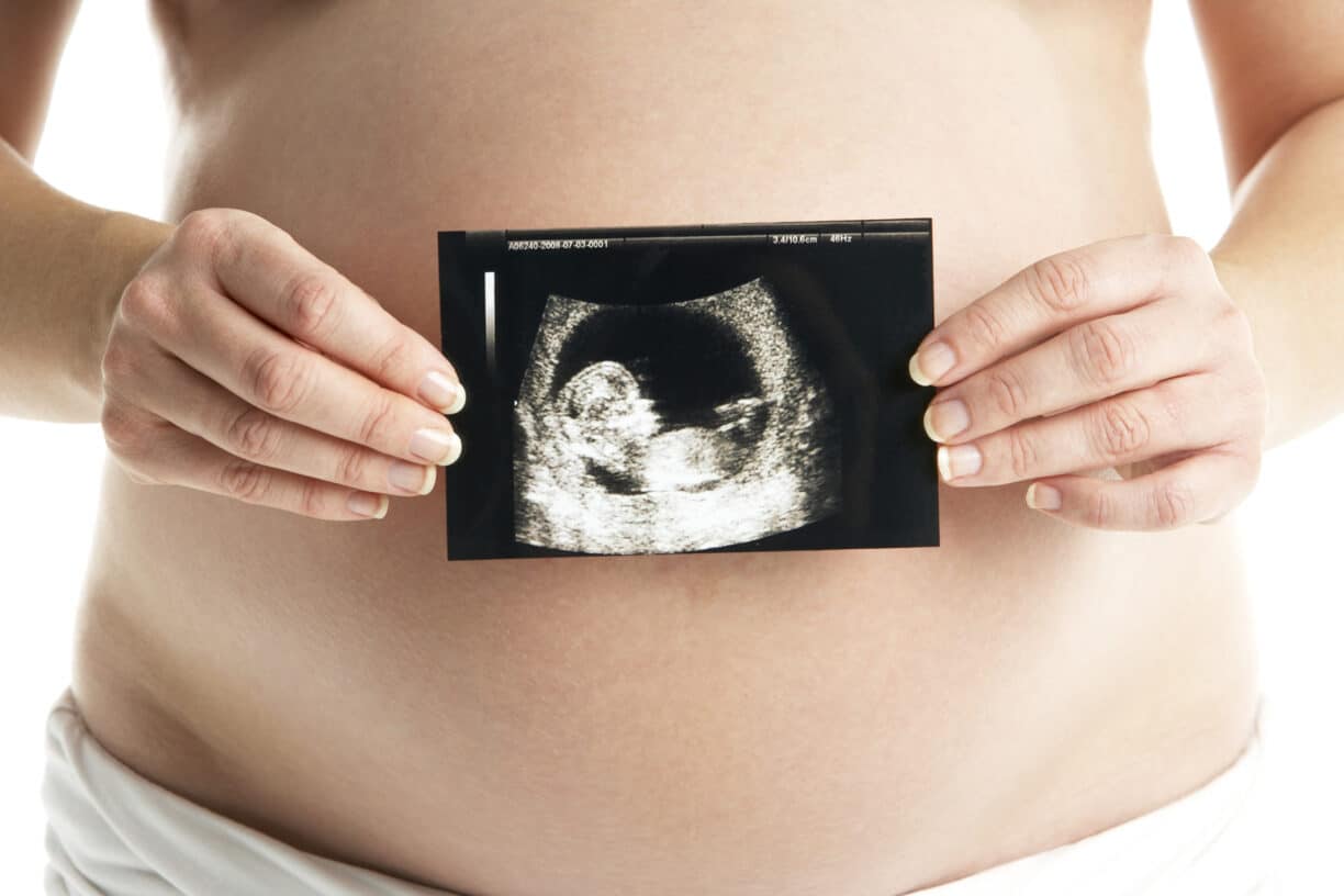 woman holds baby scan against her pregnant belly