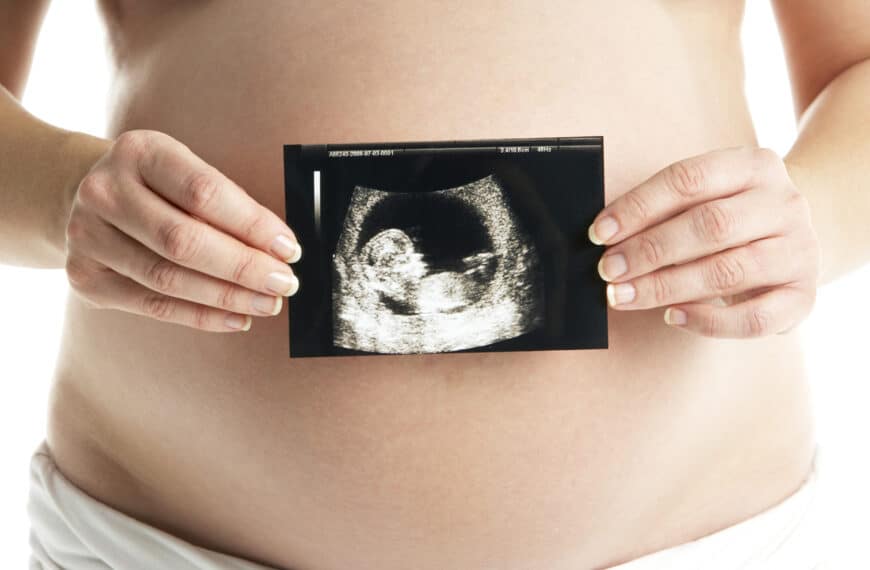 woman holds baby scan against her pregnant belly