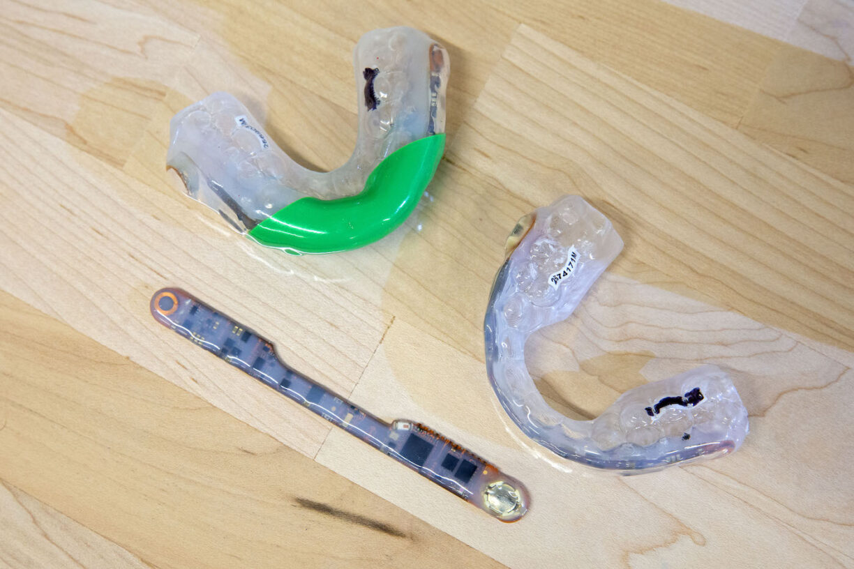 Mouthguard instrumented with sensors 1