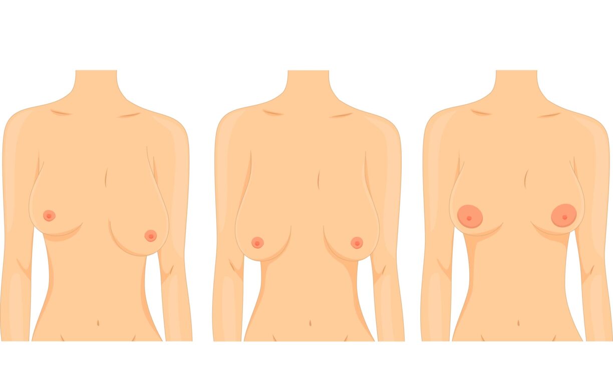 graphic showing breasts