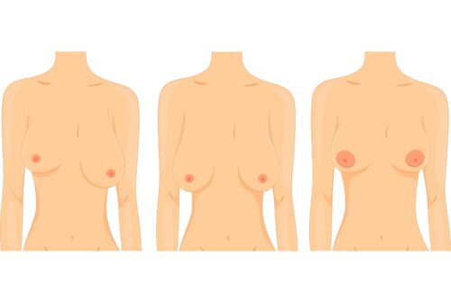 graphic showing breasts scaled
