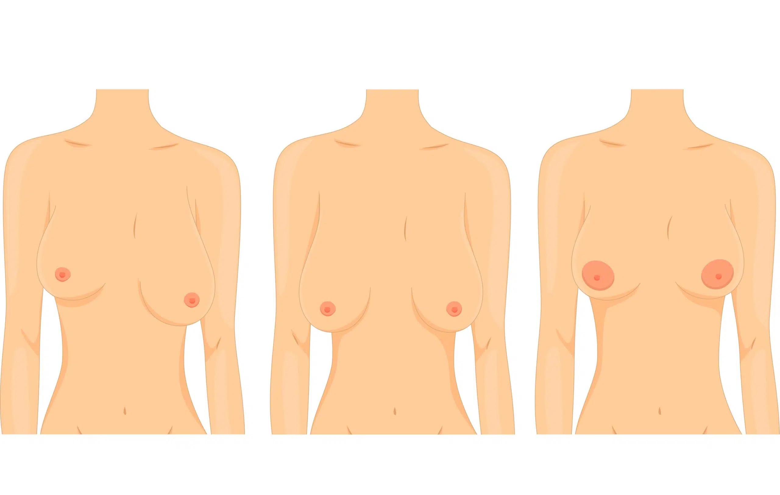 Graphic showing breasts scaled