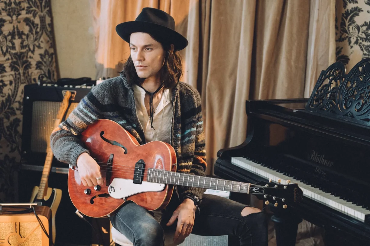 James Bay with his guitar