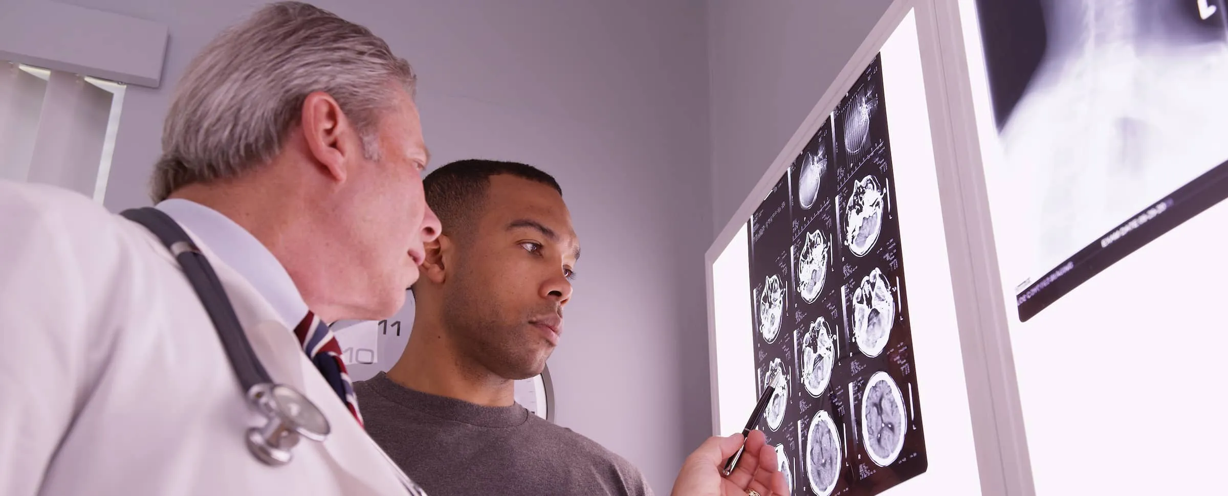 Mid aged medical doctor reviewing x ray of male patient