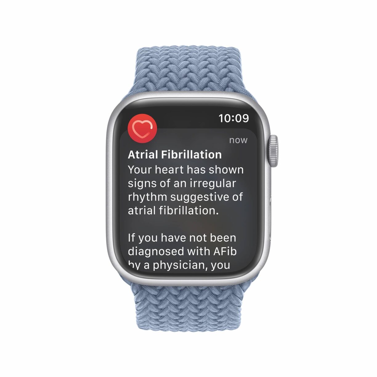 Apple watch_irregular rhythm notifications