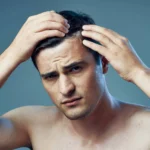 Young man checking hairline
