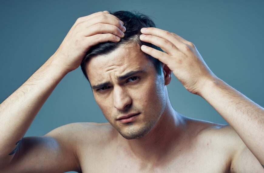 Young man checking hairline