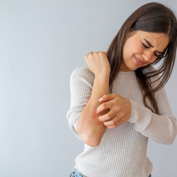 Woman scratching her arm