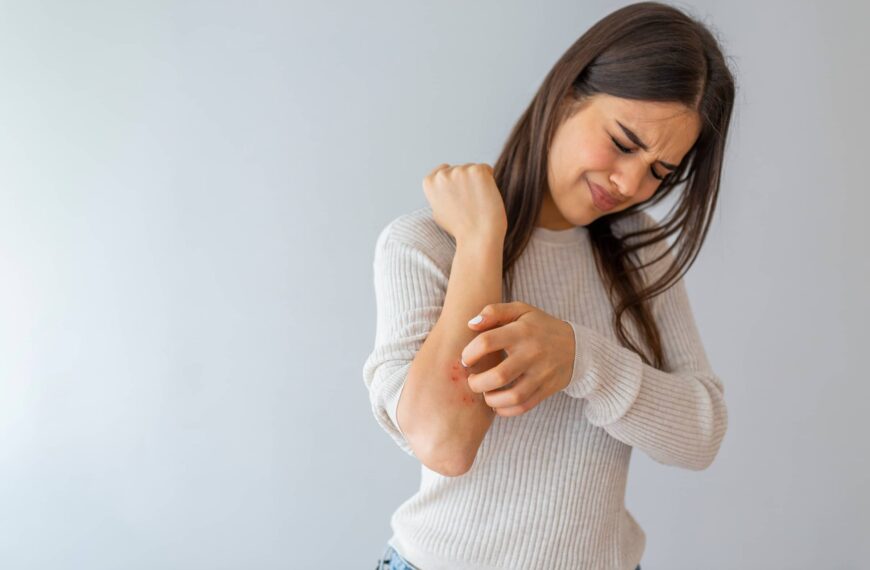 Woman scratching her arm