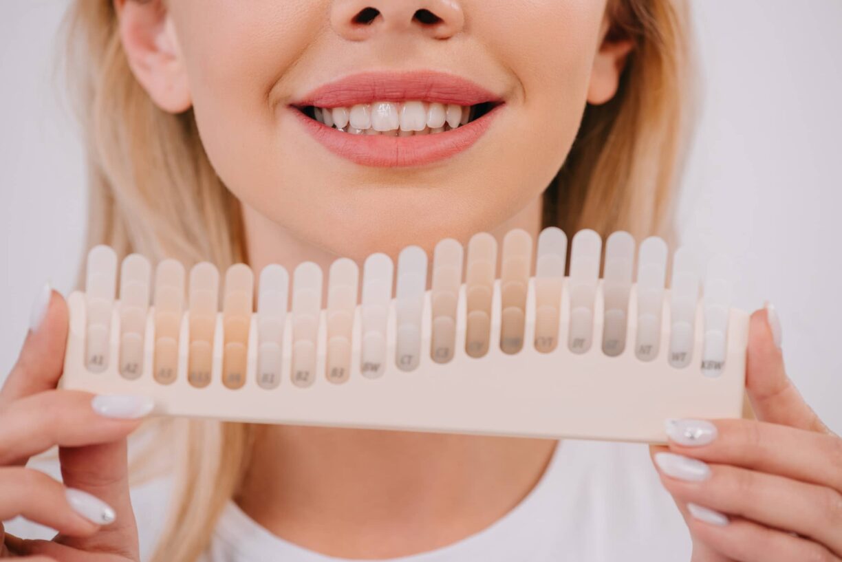 smiling-woman-holding-teeth-color-chart