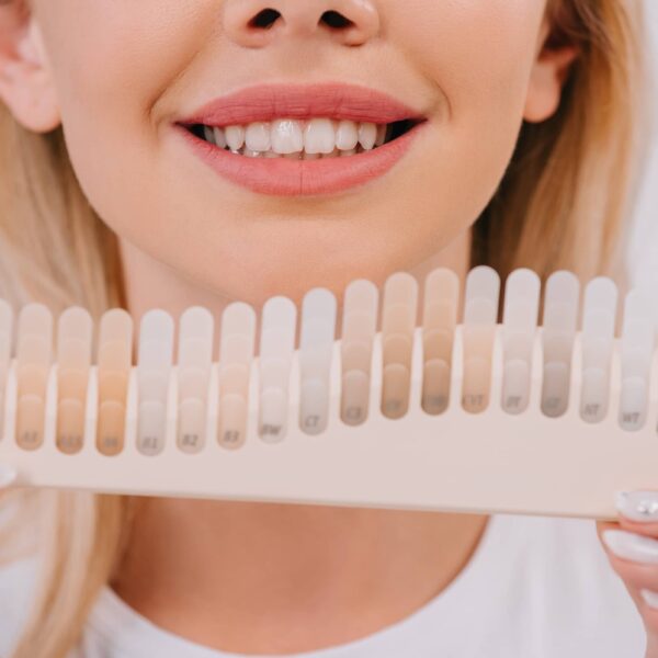 smiling-woman-holding-teeth-color-chart