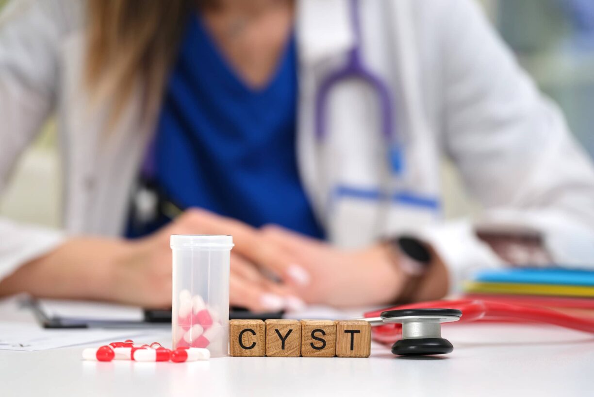 A healthcare professional examines treatment options for cysts, considering medication and specialized tools