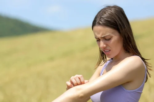Allergic woman scratching itchy arm in a field