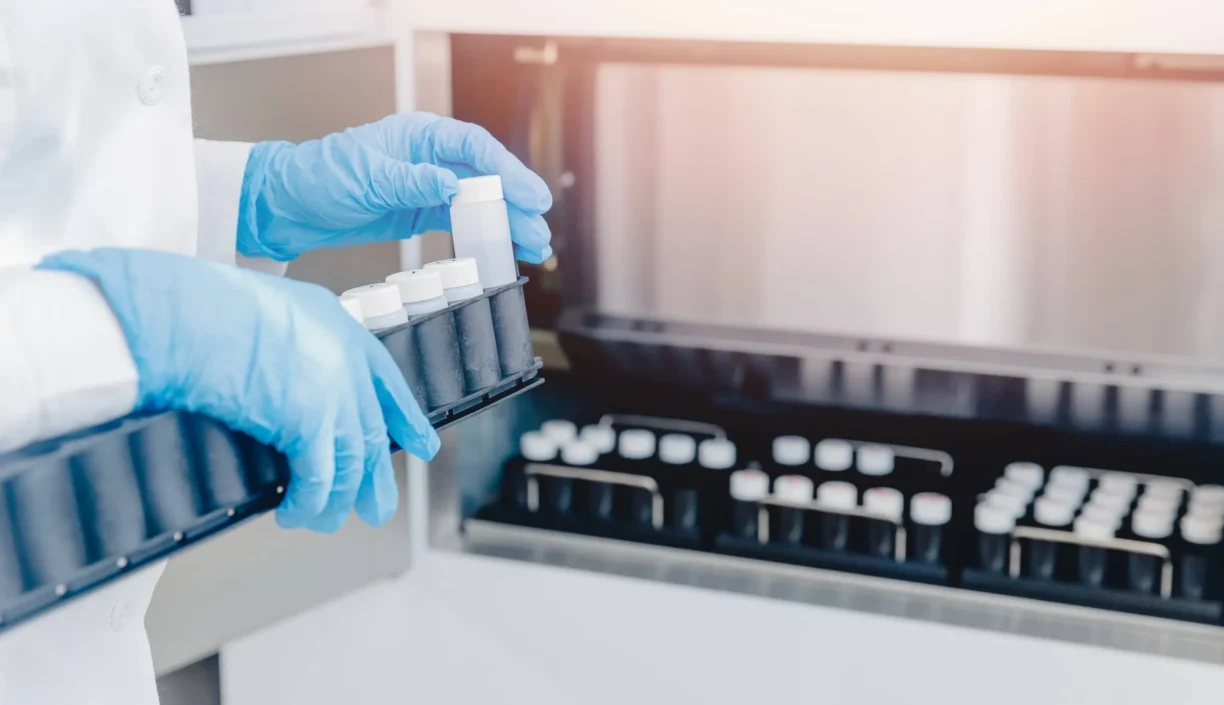 Sample Test Bottles